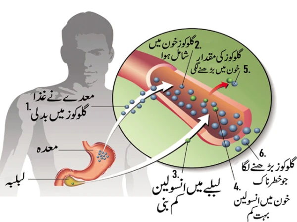 Revolutionary treatment discovered to end type 1 diabetes