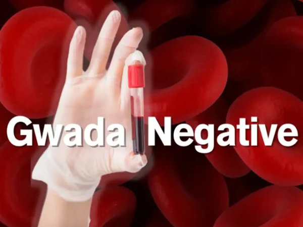 French scientists discover 48th blood group