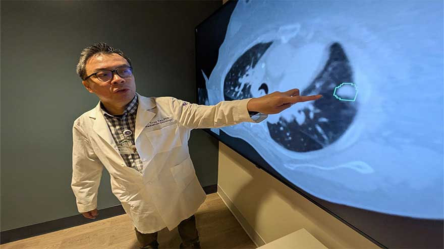 AI detects hidden lung tumours doctors miss