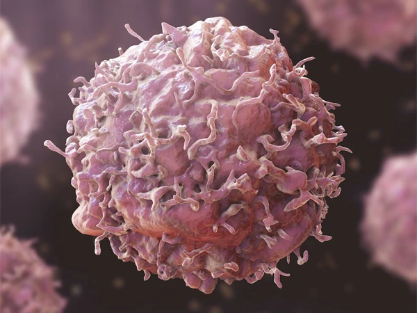 Several everyday items may cause cancer: Research