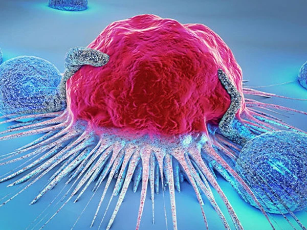 Major breakthrough in new bladder cancer treatment