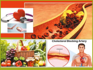High cholesterol: A silent danger that can affect the heart, how can it be prevented?