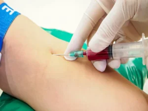 Trial of new blood test for prostate cancer