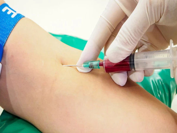 Trial of new blood test for prostate cancer