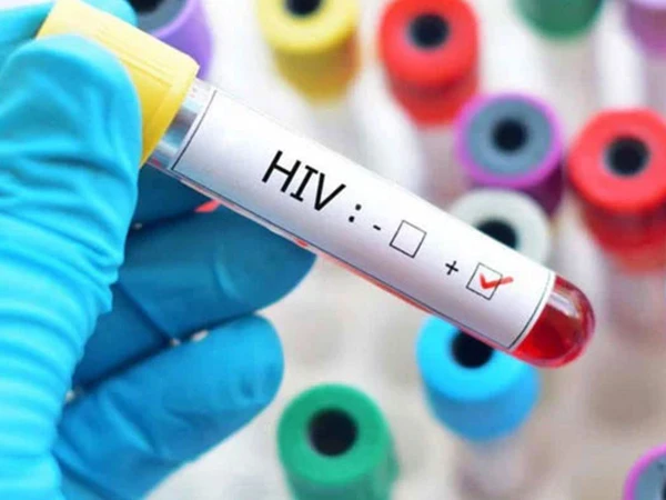 HIV cases on the rise; ban on 10cc syringes declared a threat to newborn treatment